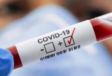 Photo of БІР ТӘУЛІКТЕ COVID-19-ДЫҢ 220 ЖАҒДАЙЫ ТІРКЕЛДІ