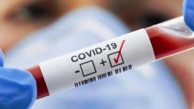 Photo of БІР ТӘУЛІКТЕ COVID-19-ДЫҢ 220 ЖАҒДАЙЫ ТІРКЕЛДІ